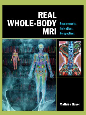 cover image of Real Whole Body MRI